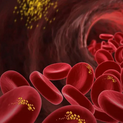 Czy za wysoki poziom cholesterolu odpowiada ten pochodzący z żywności?